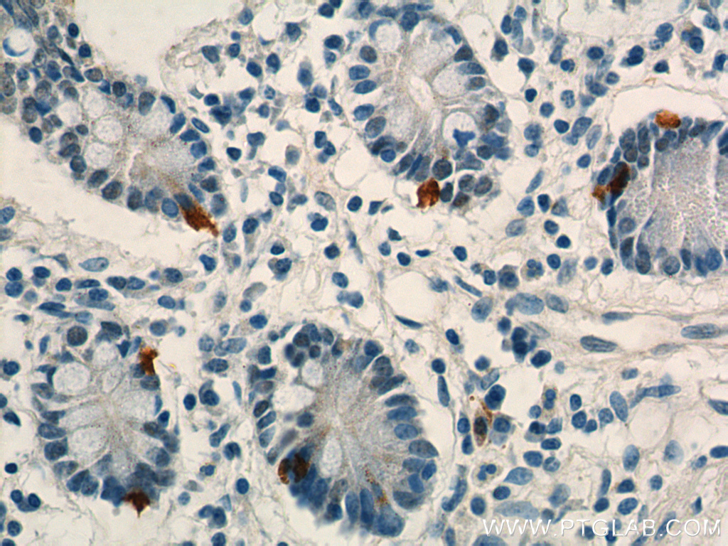 LGR4 Polyclonal antibody