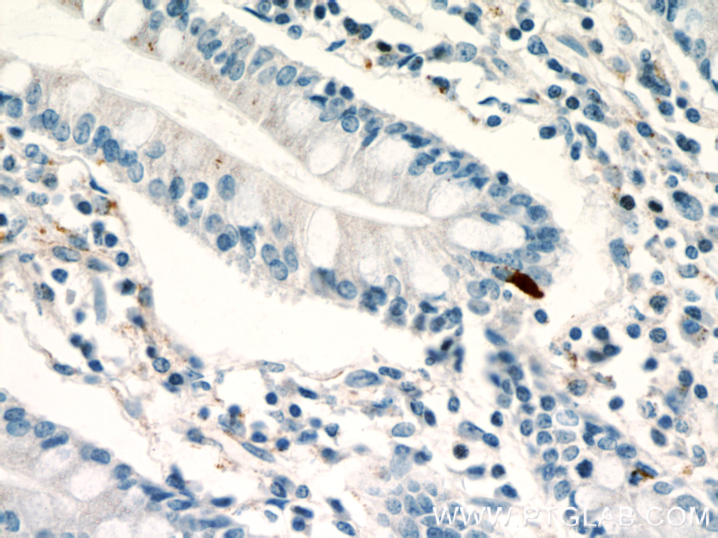 IHC staining of human small intestine using 21833-1-AP