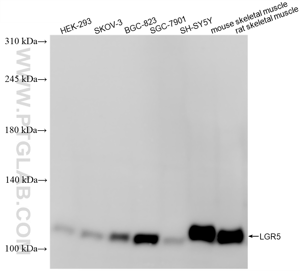 Various lysates were subjected to SDS PAGE followed by western blot with 86627-1-RR (LGR5 antibody) at dilution of 1:2000 incubated at room temperature for 1.5 hours. WB analysis using 86627-1-RR