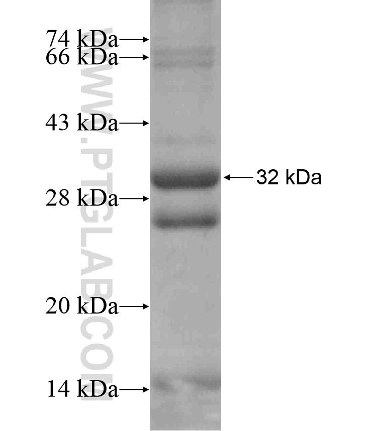 LGR5 fusion protein Ag17162 SDS-PAGE LGR5 fusion protein Ag17162 SDS-PAGE
