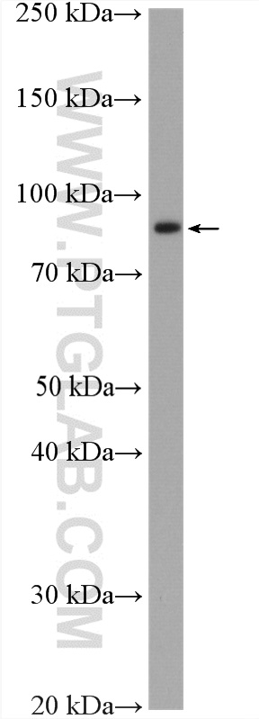 WB analysis of HUVEC using 17658-1-AP