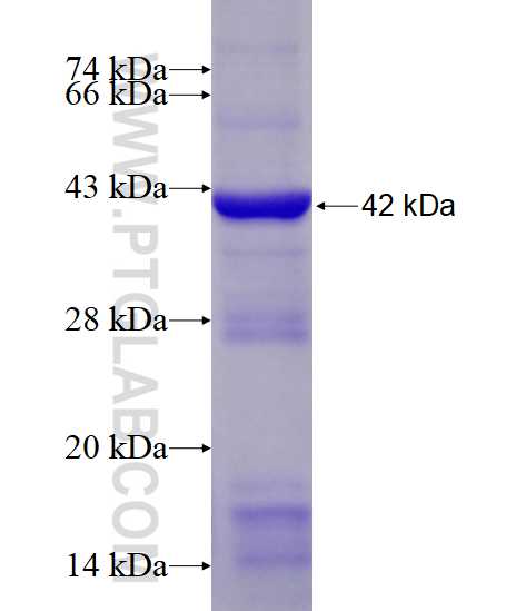 LGR6 fusion protein Ag11924 SDS-PAGE LGR6 fusion protein Ag11924 SDS-PAGE