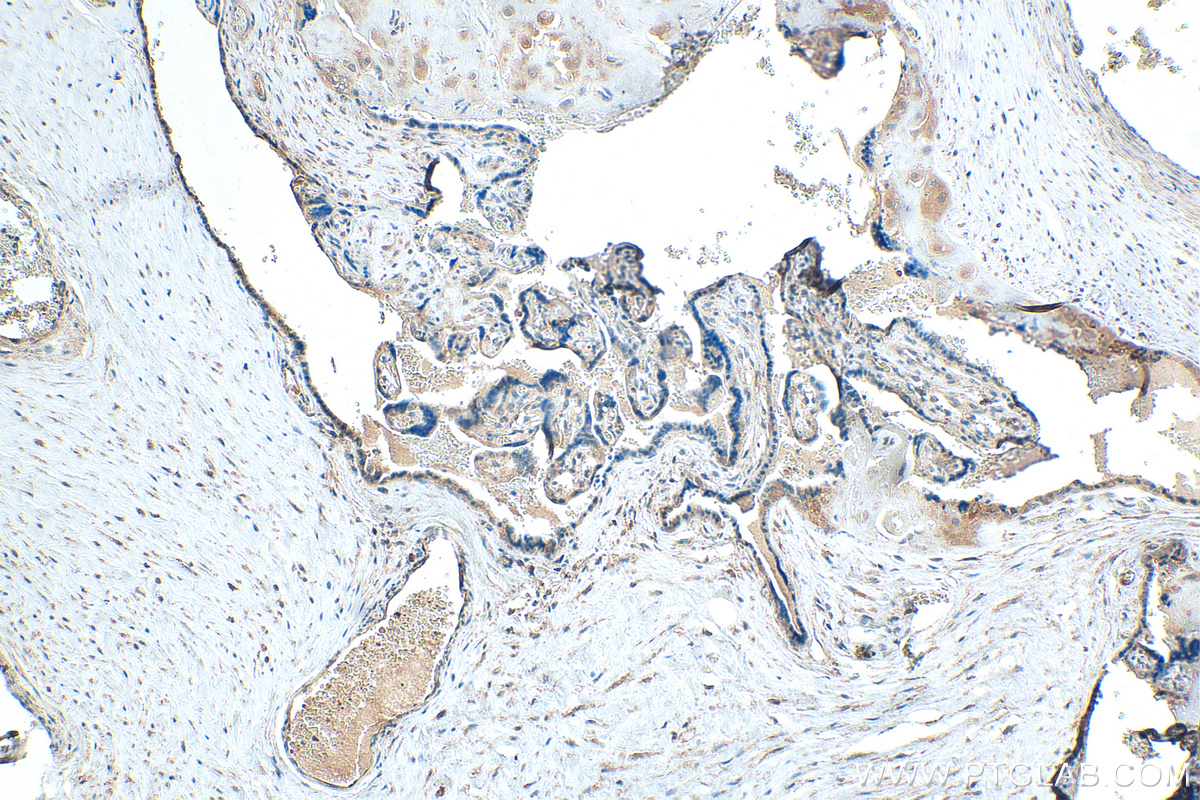 IHC staining of human placenta using 21005-1-AP