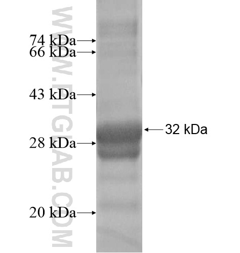 LHFPL1 fusion protein Ag15208 SDS-PAGE LHFPL1 fusion protein Ag15208 SDS-PAGE
