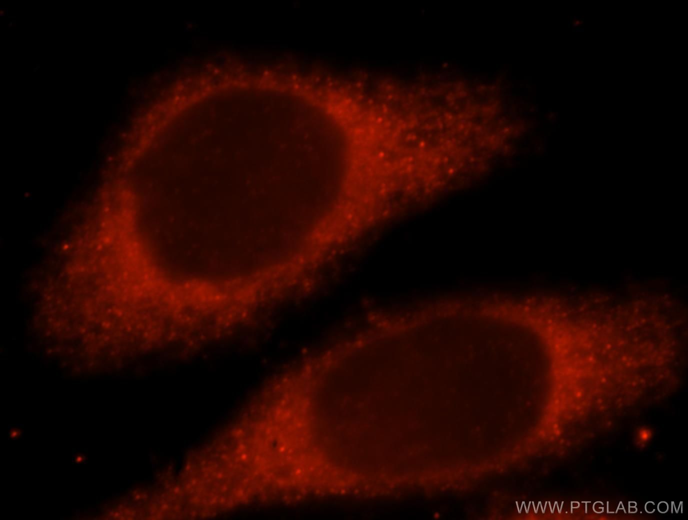 IF Staining of HeLa using 15759-1-AP