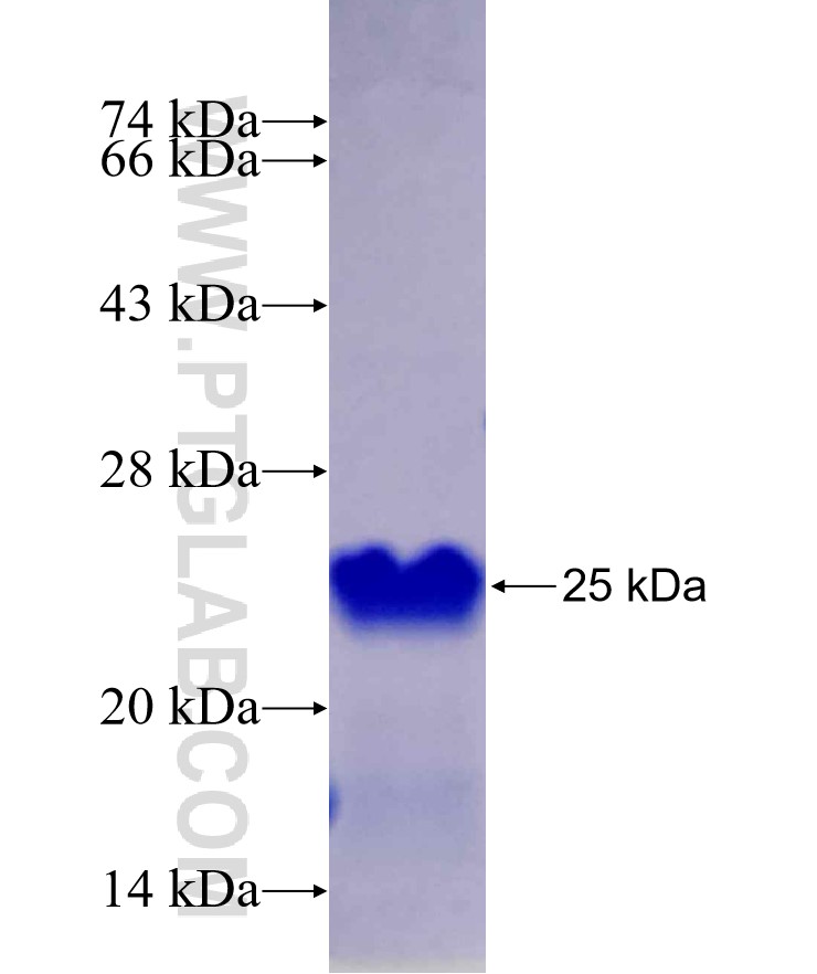 LHX1 fusion protein Ag29740 SDS-PAGE LHX1 fusion protein Ag29740 SDS-PAGE