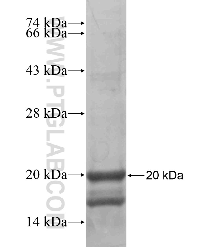 LHX1 fusion protein Ag17642 SDS-PAGE LHX1 fusion protein Ag17642 SDS-PAGE