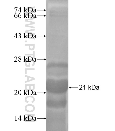 LHX3 fusion protein Ag20016 SDS-PAGE LHX3 fusion protein Ag20016 SDS-PAGE