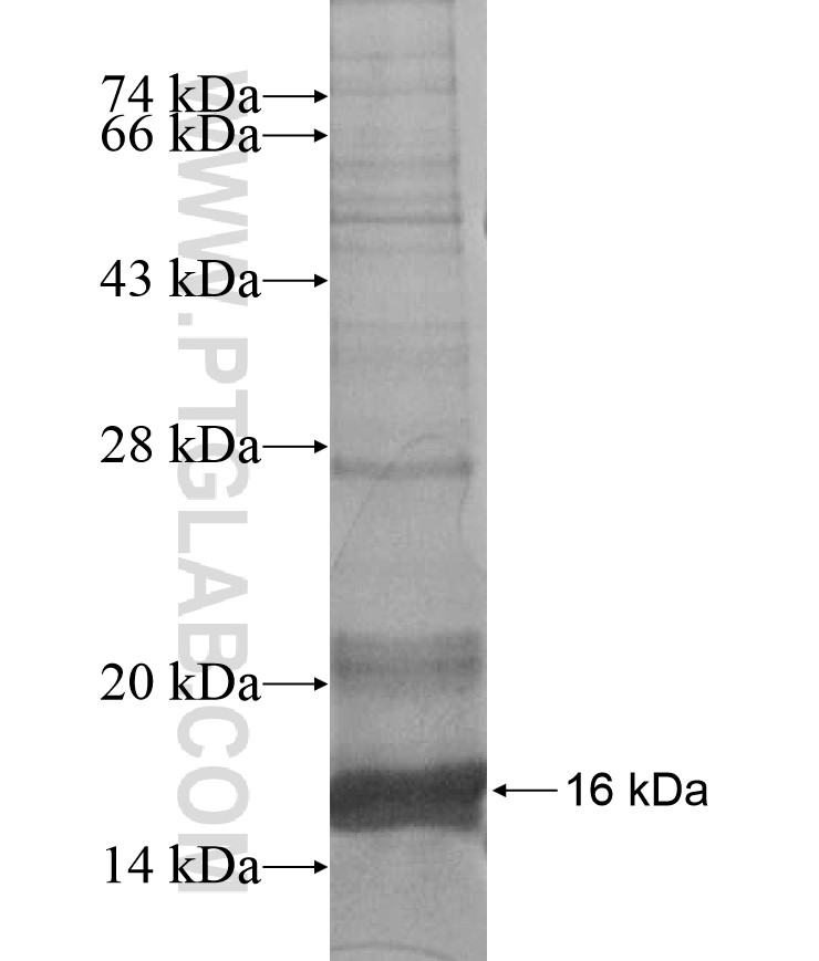 LHX6 fusion protein Ag17341 SDS-PAGE LHX6 fusion protein Ag17341 SDS-PAGE