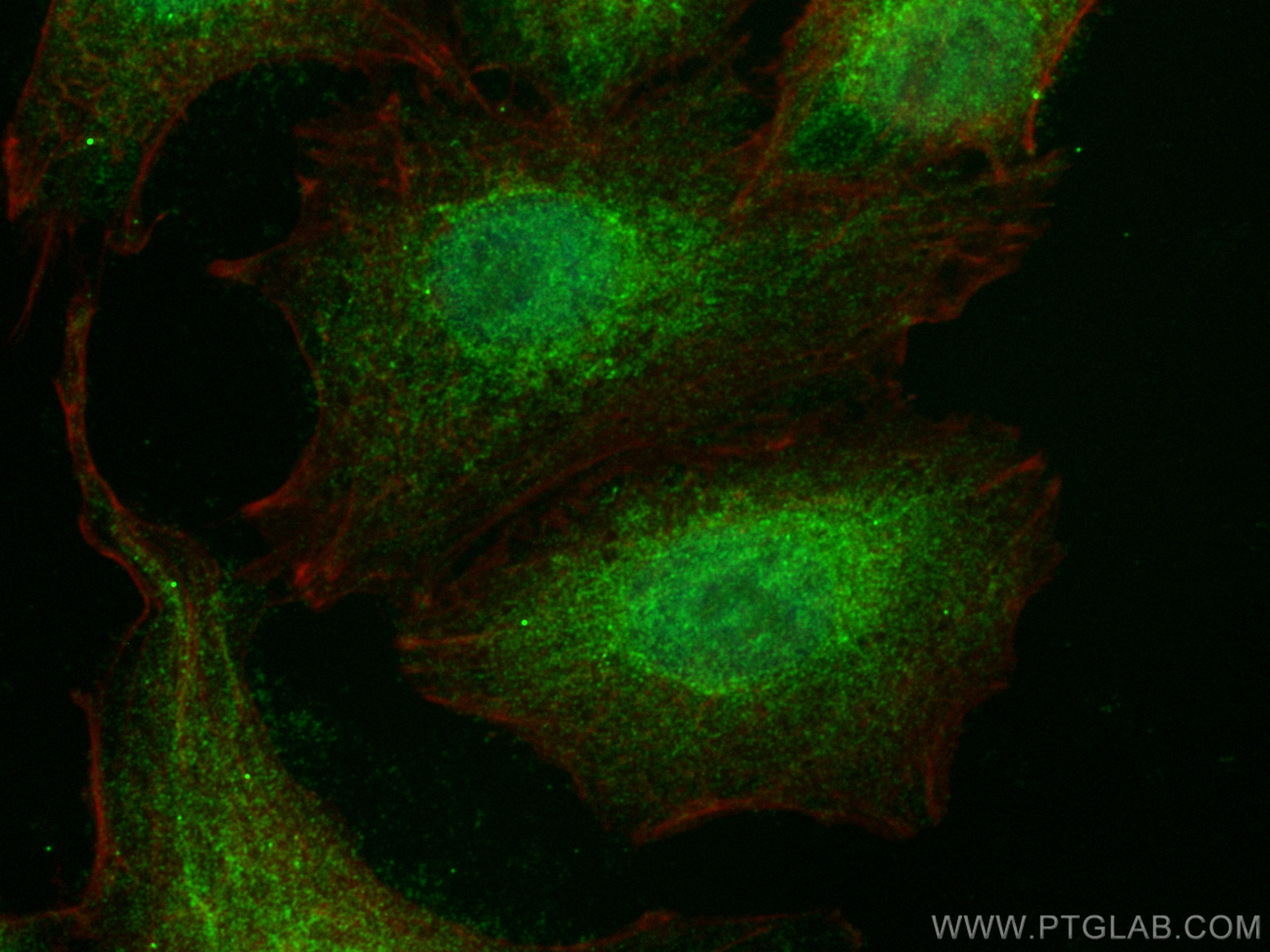 IF Staining of A549 using 30722-1-AP