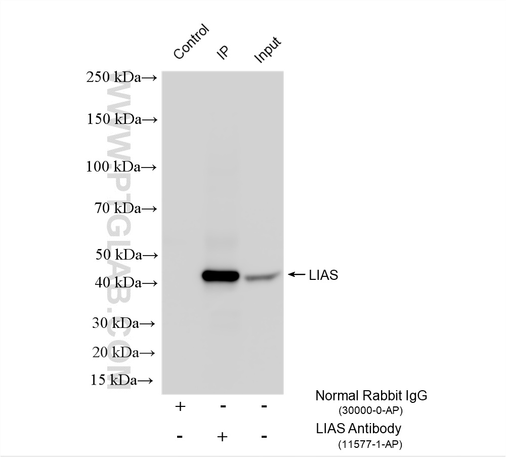 IP experiment of mouse liver using 11577-1-AP IP experiment of mouse liver using 11577-1-AP