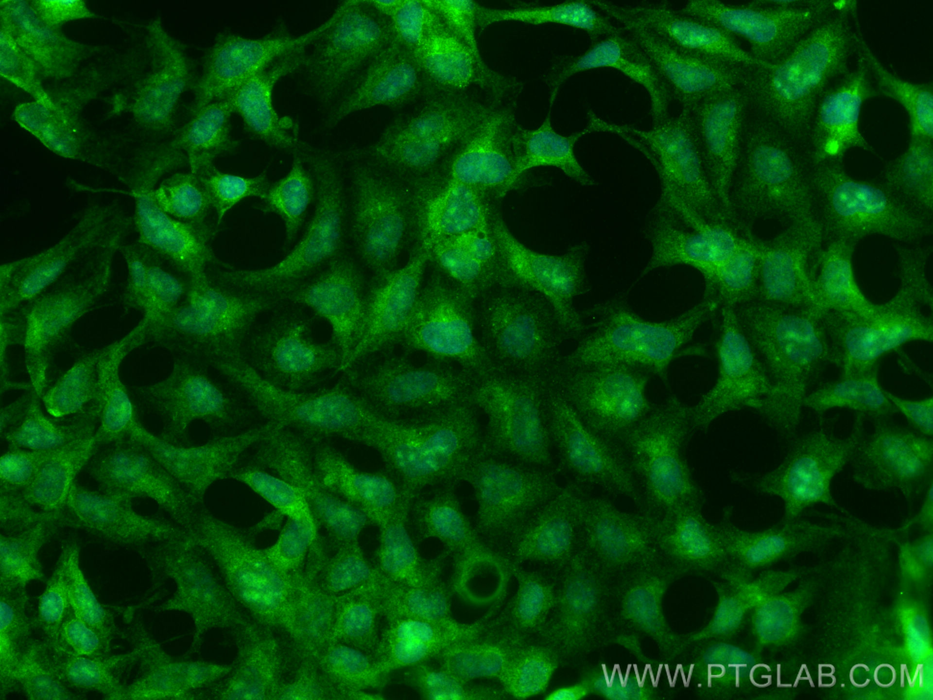 IF Staining of HEK-293 using 31796-1-AP (same clone as 31796-1-PBS)