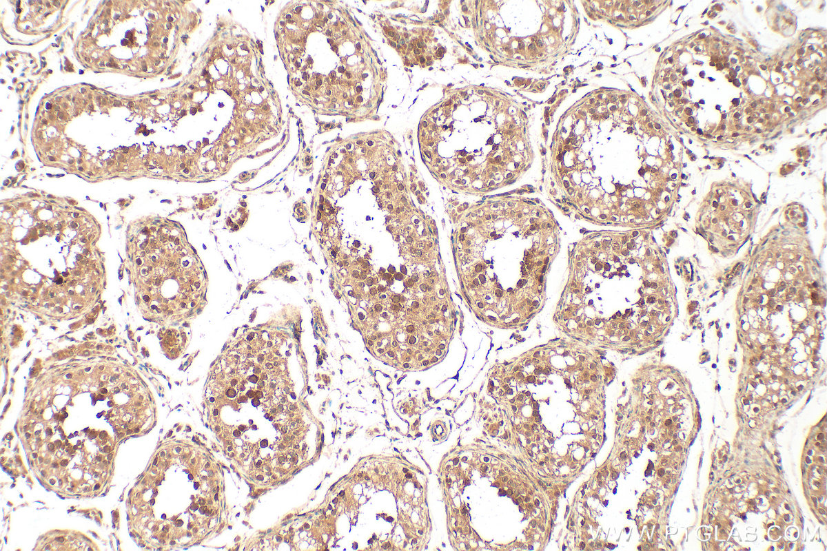 IHC staining of human testis using 31796-1-AP