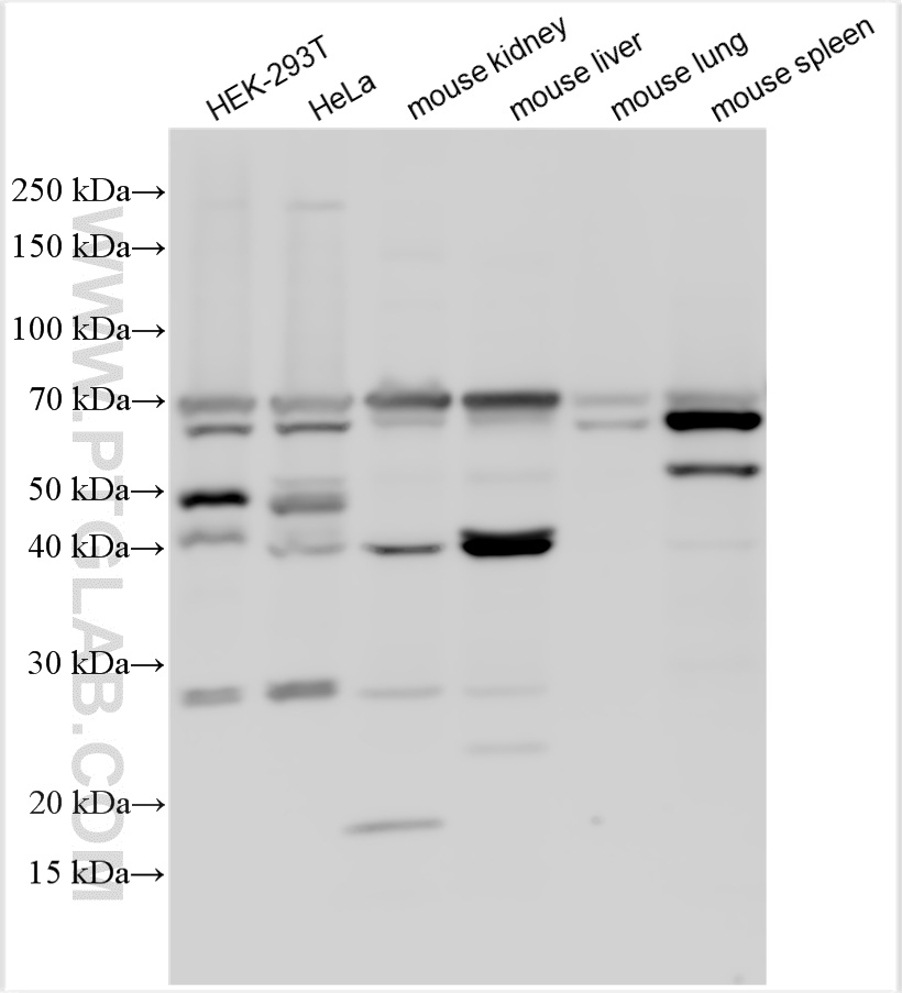 WB analysis using 31796-1-AP (same clone as 31796-1-PBS)