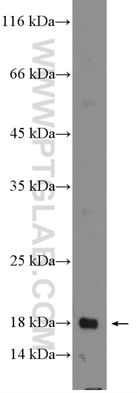 LIF Polyclonal antibody