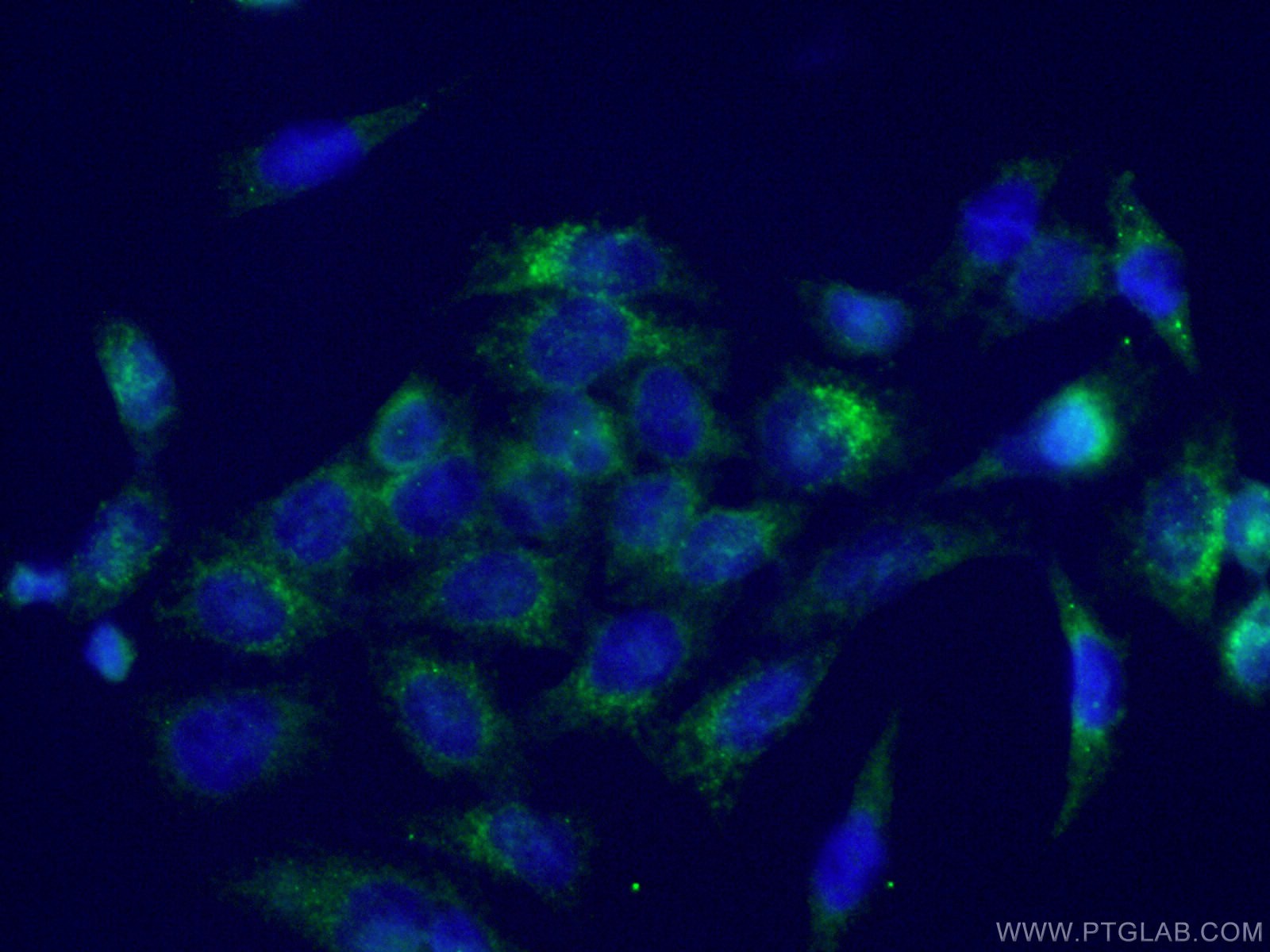 IF Staining of HeLa using 22779-1-AP