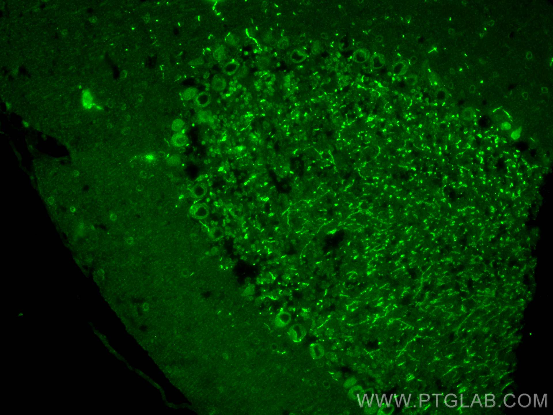 IF Staining of mouse cerebellum using 22779-1-AP
