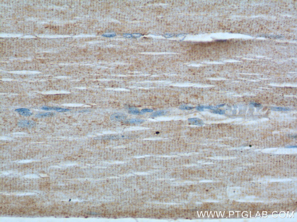 IHC staining of human skeletal muscle using 22779-1-AP
