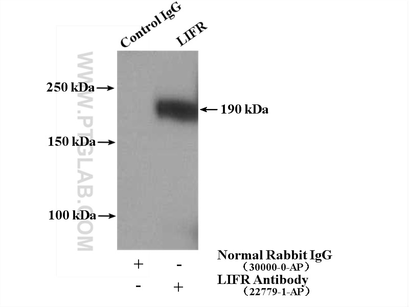 IP experiment of mouse skeletal muscle using 22779-1-AP