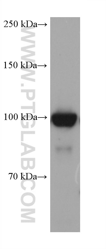 DNA ligase III/LIG3