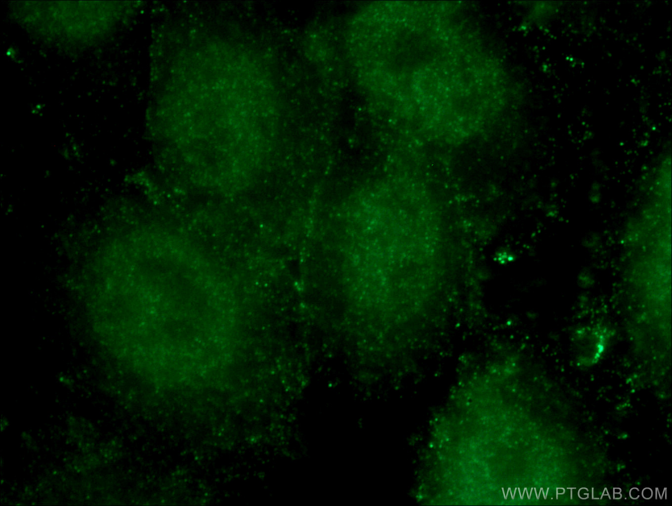 IF Staining of HepG2 using 66705-1-Ig