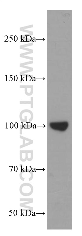 WB analysis of PC-3 using 66705-1-Ig