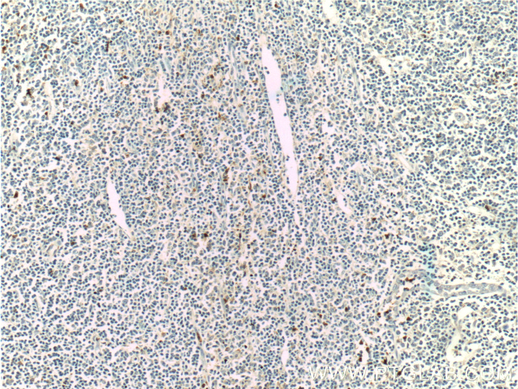 IHC staining of human tonsillitis using 11461-1-AP