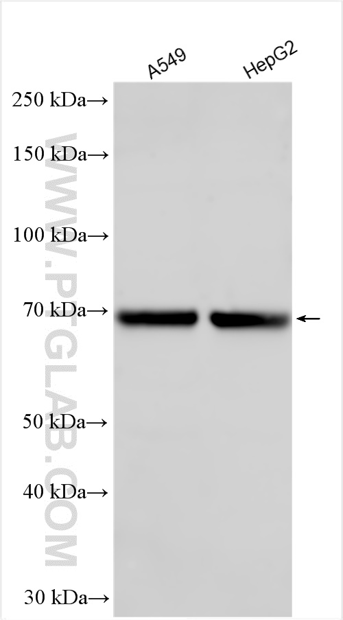 WB analysis using 30285-1-AP