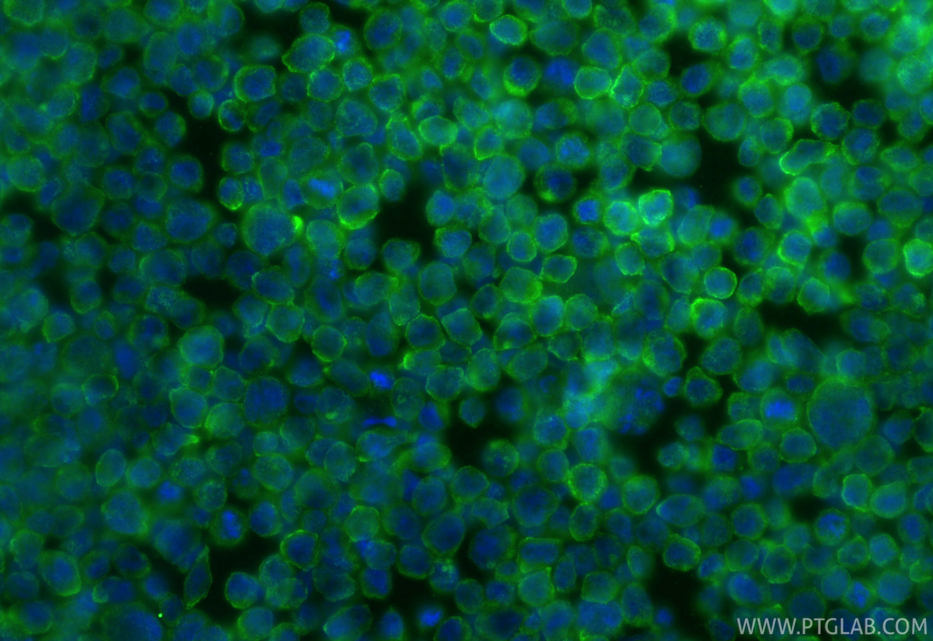 Immunofluorescent analysis of (4% PFA) fixed HL-60 cells using LILRA4 antibody (21153-1-AP) at dilution of 1:400 and CoraLite®488-Conjugated Goat Anti-Rabbit IgG(H+L) (<a class='green' href='/productredirect?CatalogNo=SA00013-2' target='_blank'>SA00013-2</a>). IF Staining of HL-60 using 21153-1-AP