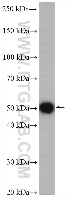 WB analysis of mouse spleen using 21153-1-AP