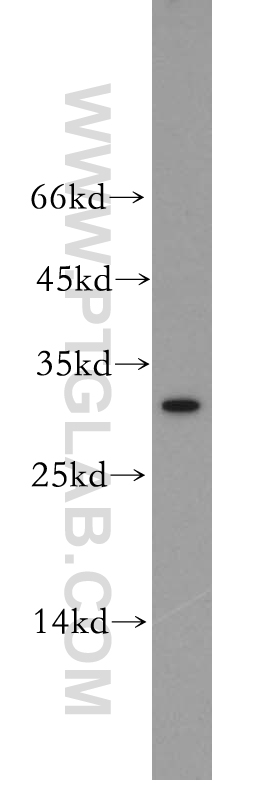 WB analysis of K-562 using 18821-1-AP