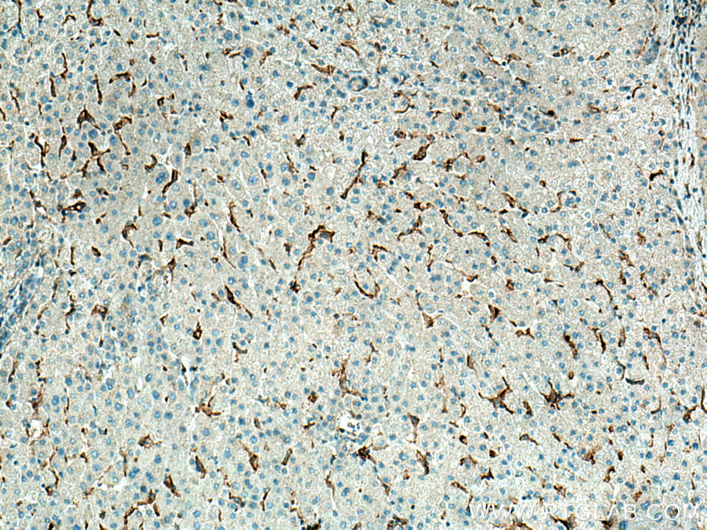 IHC staining of human liver using 26455-1-AP