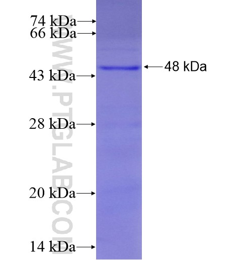 LILRB3 fusion protein Ag13101 SDS-PAGE LILRB3 fusion protein Ag13101 SDS-PAGE