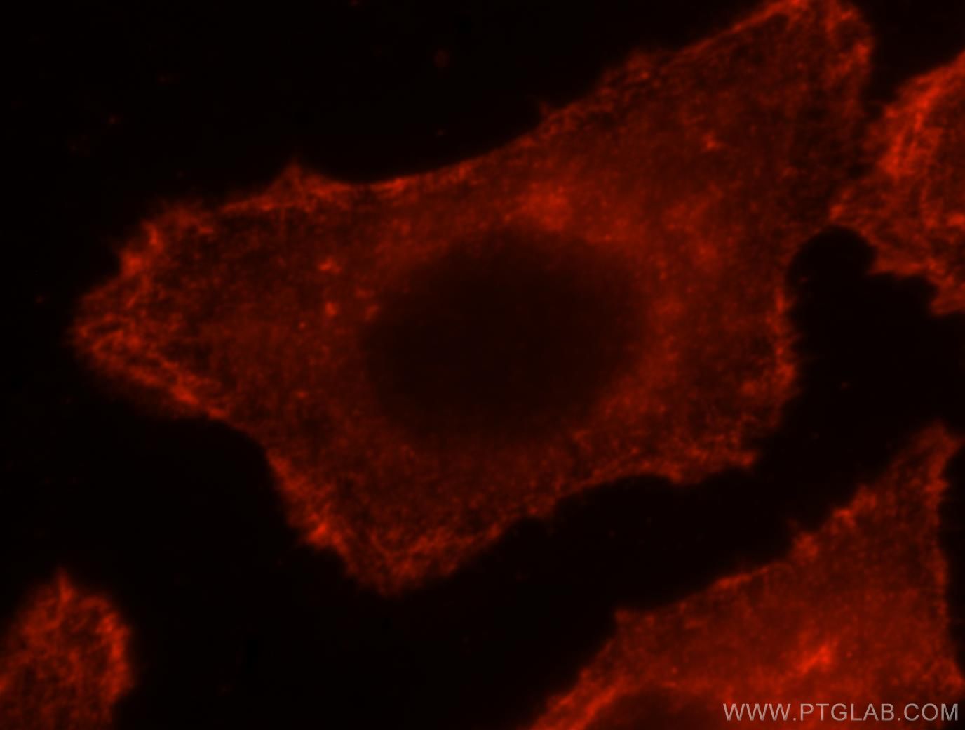 IF Staining of HepG2 using 16639-1-AP