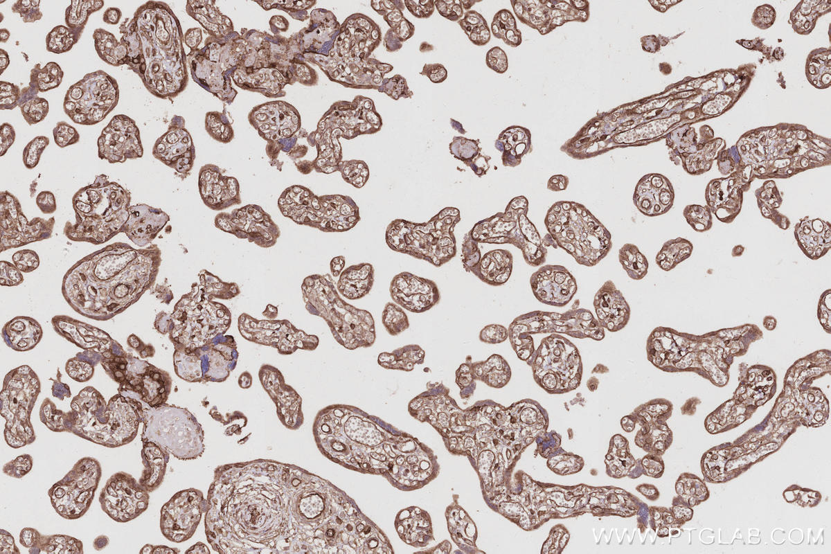IHC staining of human placenta using 16639-1-AP IHC staining of human placenta using 16639-1-AP