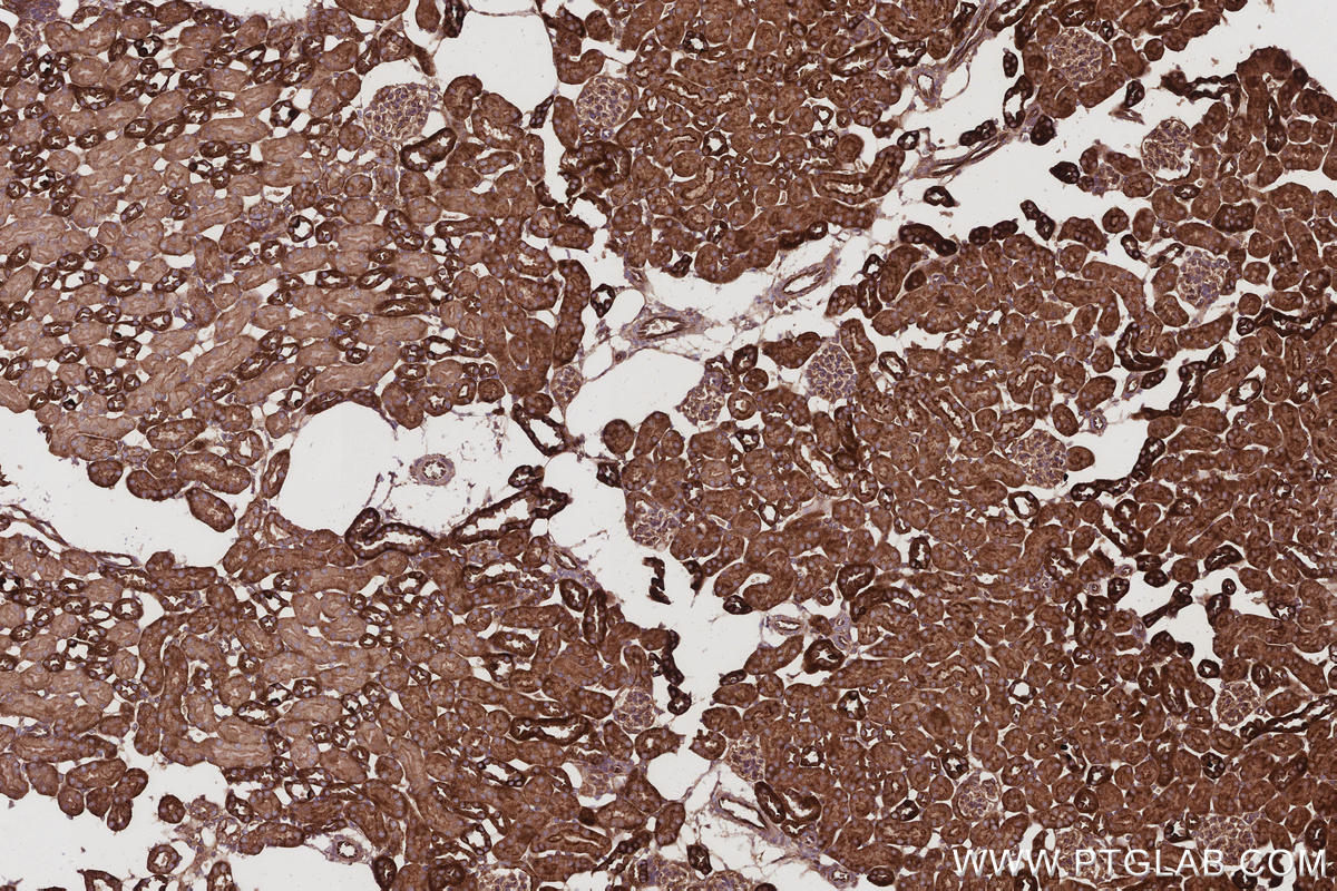 IHC staining of mouse kidney using 16639-1-AP IHC staining of mouse kidney using 16639-1-AP