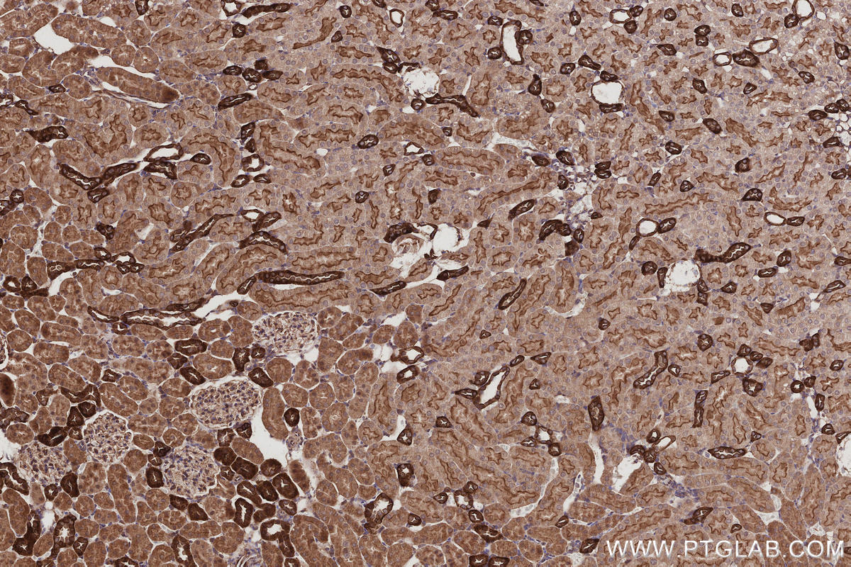 IHC staining of rat kidney using 16639-1-AP IHC staining of rat kidney using 16639-1-AP