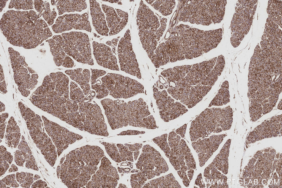 IHC staining of rat pancreas using 16639-1-AP IHC staining of rat pancreas using 16639-1-AP