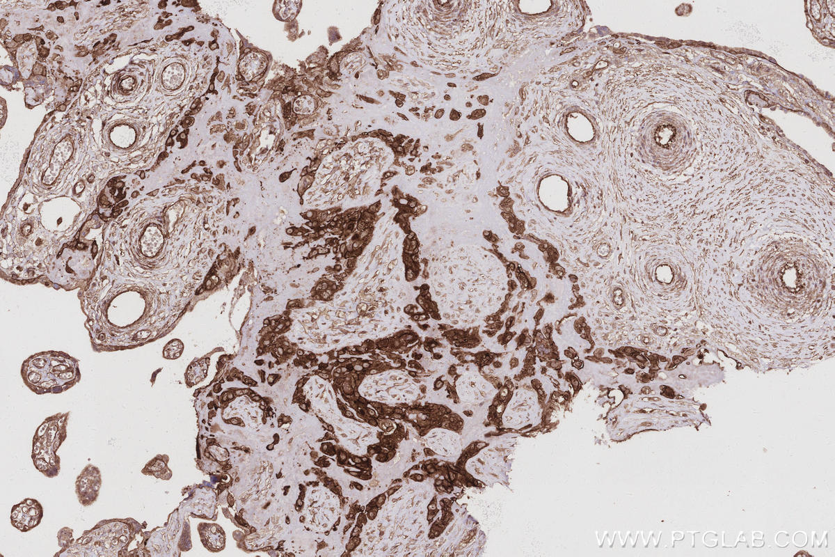 IHC staining of human placenta using 16639-1-AP IHC staining of human placenta using 16639-1-AP