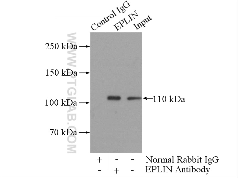 IP experiment of mouse liver using 16639-1-AP