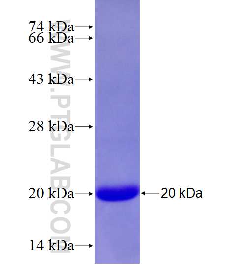 LIMD1 fusion protein Ag28057 SDS-PAGE LIMD1 fusion protein Ag28057 SDS-PAGE