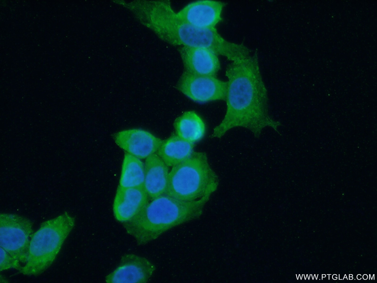 IF Staining of HeLa using 19699-1-AP