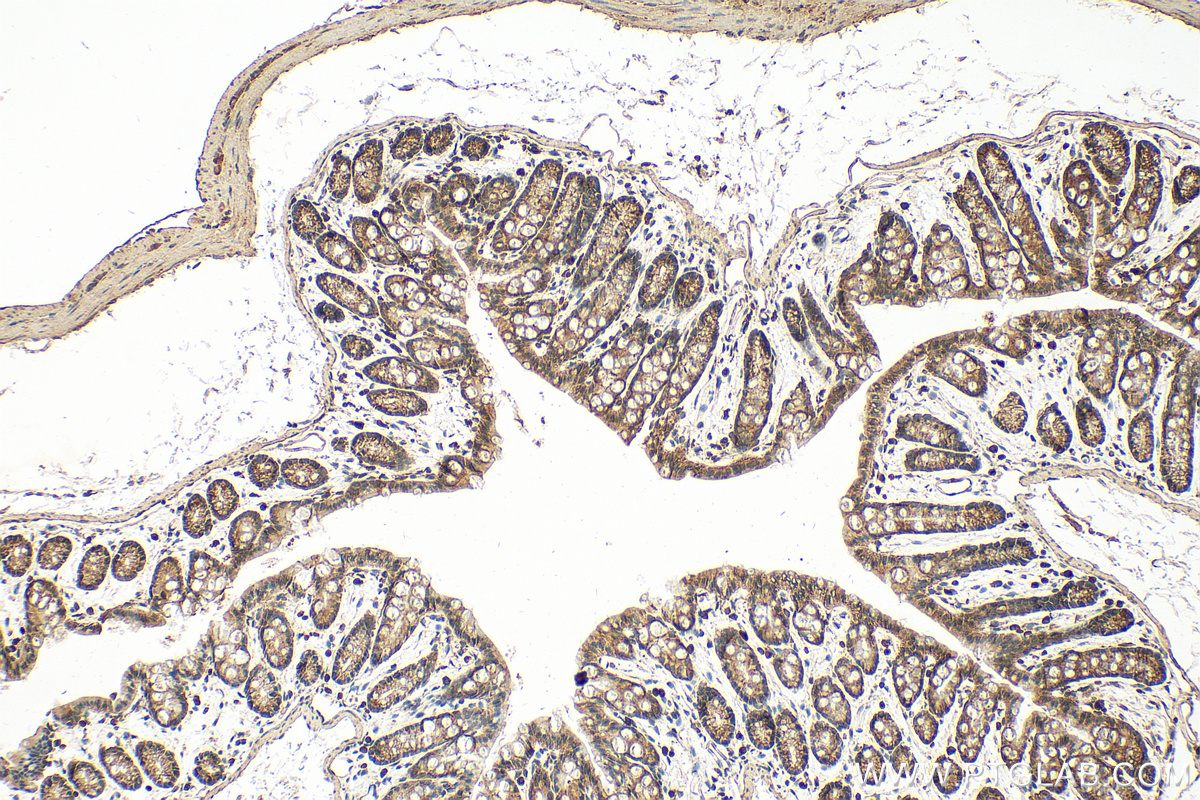 IHC staining of mouse colon using 19699-1-AP