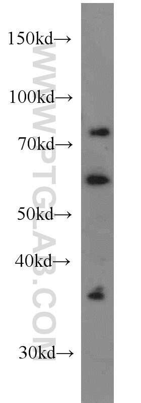 LIMK1 Polyclonal antibody