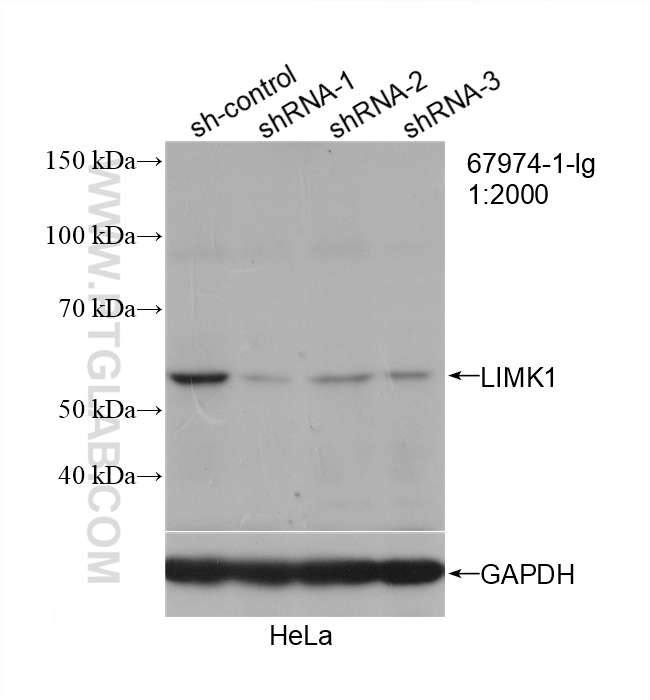 WB analysis of HeLa using 67974-1-Ig