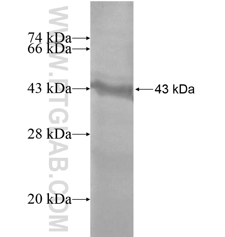 LIMK1 fusion protein Ag16220 SDS-PAGE LIMK1 fusion protein Ag16220 SDS-PAGE
