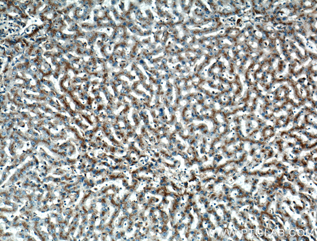IHC staining of human liver using 27102-1-AP