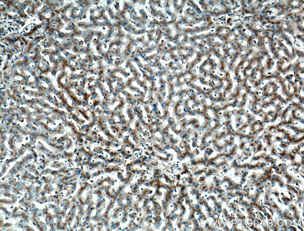 LIMPII Polyclonal antibody