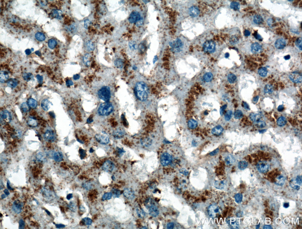 IHC staining of human liver using 27102-1-AP