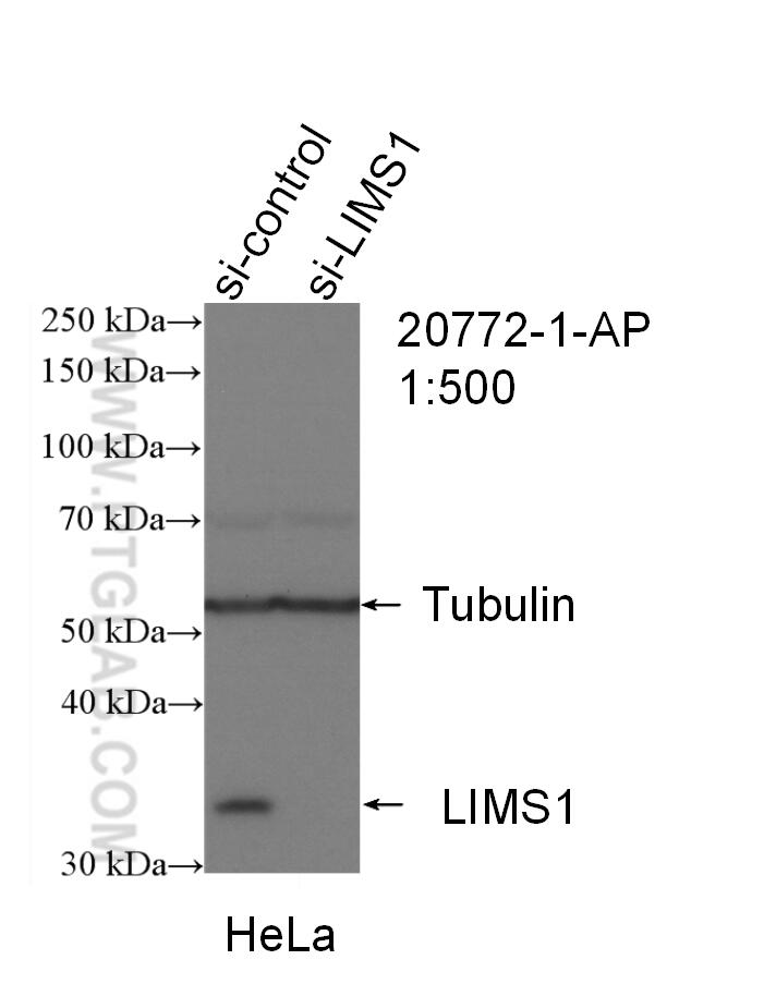 WB analysis of HeLa using 20772-1-AP